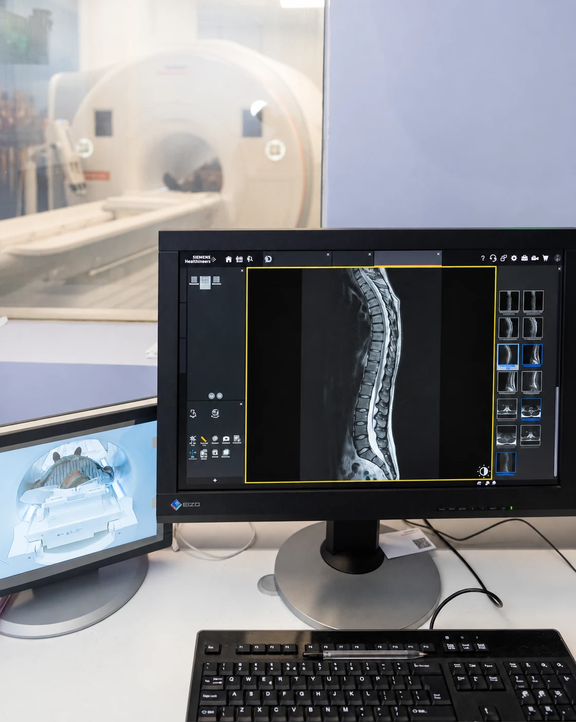 Postazione di risonanza magnetica con immagini della colonna e apparecchiatura dello studio